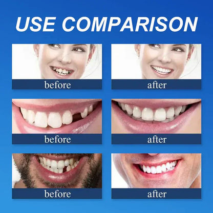⏰Final 3 Hours : 50%OFF🏆2026 Bestselling Product🦷 Fit for a Fresh Smile, Say Goodbye to Wearing Discomfort!🌎