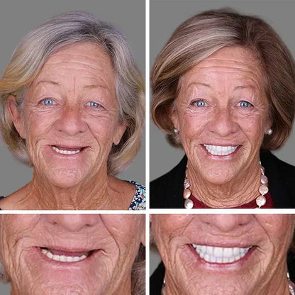 ⏰Final 3 Hours : 50%OFF🏆2026 Bestselling Product🦷 Fit for a Fresh Smile, Say Goodbye to Wearing Discomfort!🌎