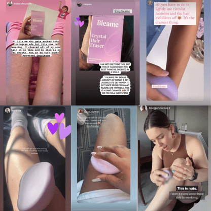 KLENIMORE™ Crystal Hair Eraser ✨ – Safe, painless nano crystal physical hair remover for long-lasting silky smooth skin 🧴