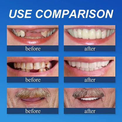 ⏰Final 3 Hours : 50%OFF🏆2026 Bestselling Product🦷 Fit for a Fresh Smile, Say Goodbye to Wearing Discomfort!🌎